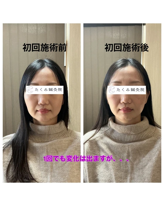 画像302