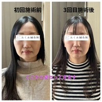 画像304