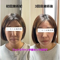 画像329