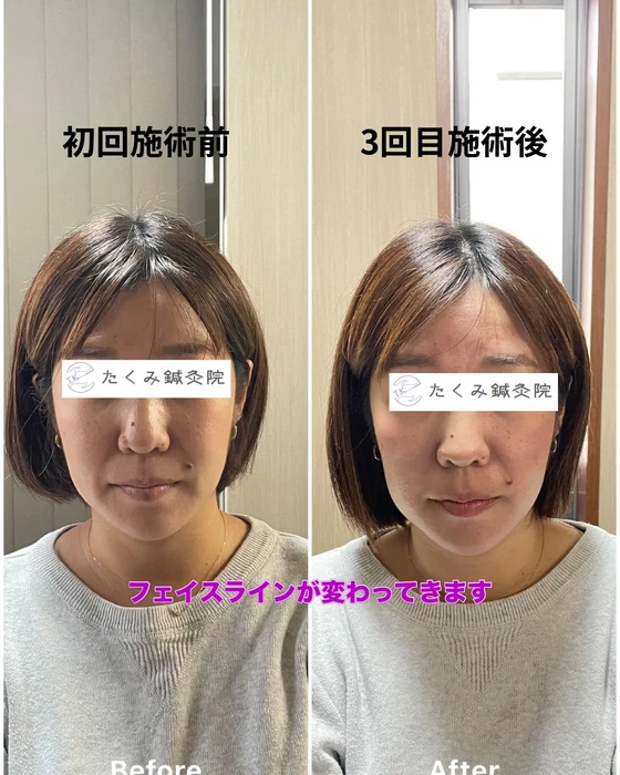 画像329